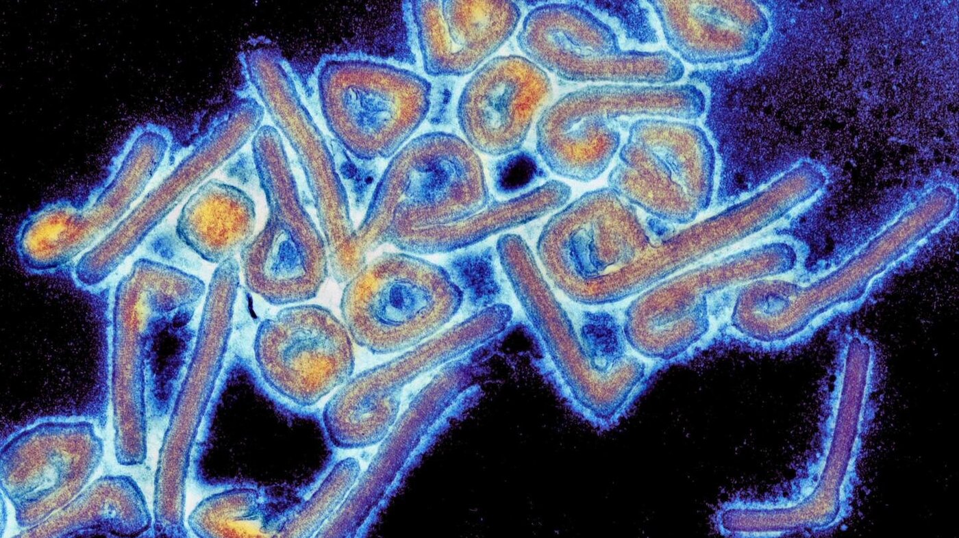 Bildet viser et mikrofotografi av et marburgvirus 