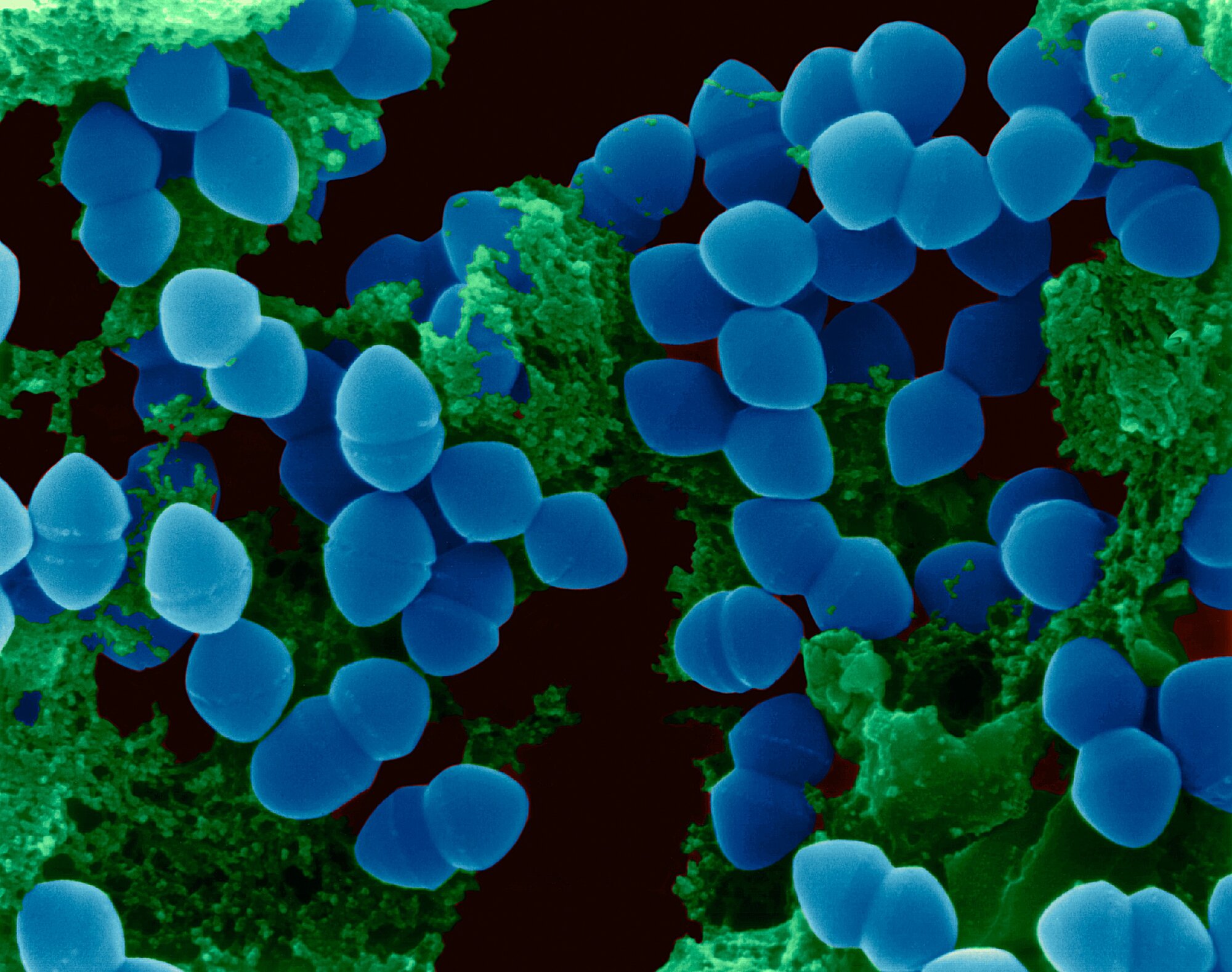 Энтерококки грамположительные. Enterococcus. Enterococcus faecium стрептококки. Enterococcus. Бактерия золотистый стафилококк.