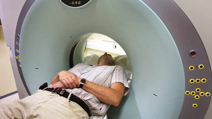 bildet viser en CT-undersøkelse