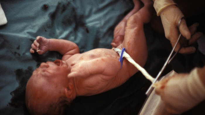 Bilde av nyfødt baby