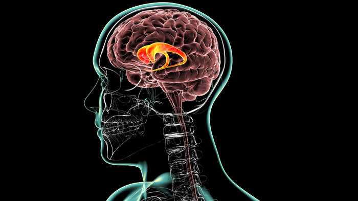 Bildet viser en illustrasjon som viser hvordan Huntington genet angriper hjernen