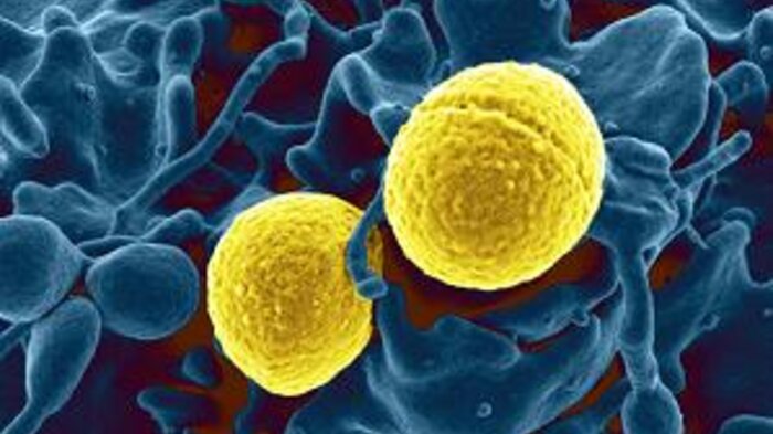 bilde av stafylokokker