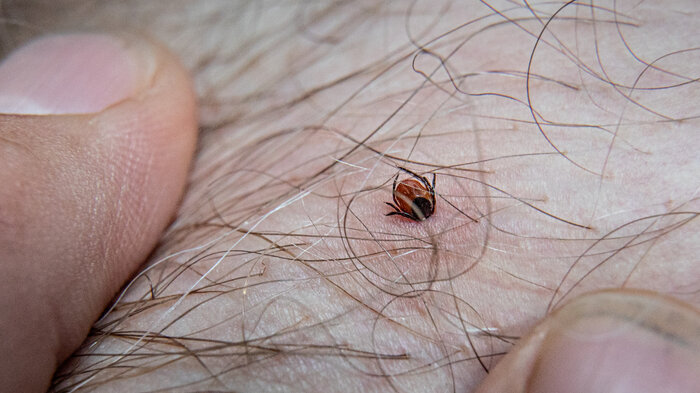 bilde av flåttbitt