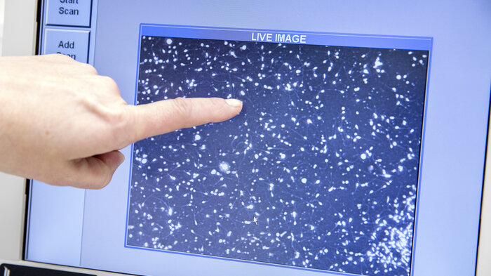 Bildet viser særprøver som vurderes.