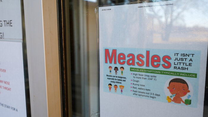 Bildet viser et skilt fra Texas som det står "meslinger" på.