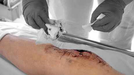 Bildet viser stell av sår.