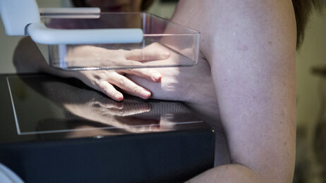 The photo shows mammography. A nurse's hand is placing a woman's breast between a glass plate and the cover beneath