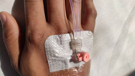 The photo shows a hand with a venous catheter in the vein