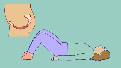 Bekkenbunnstrening Illustrasjonen viser en kvinnes bekkenbunn samt en dame som ligger på gulvet med bøyde knær, klar for bekkenbunnstrening