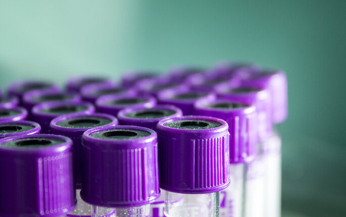 Blodprøver, prøveglass Bildet viser blodprøveglass.