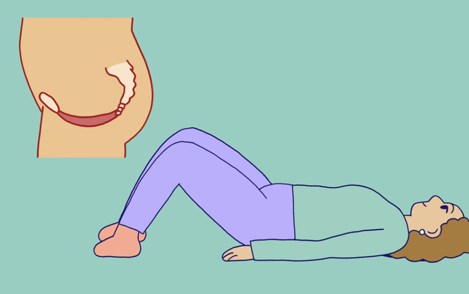 Illustrasjonen viser en kvinnes bekkenbunn samt en dame som ligger på gulvet med bøyde knær, klar for bekkenbunnstrening