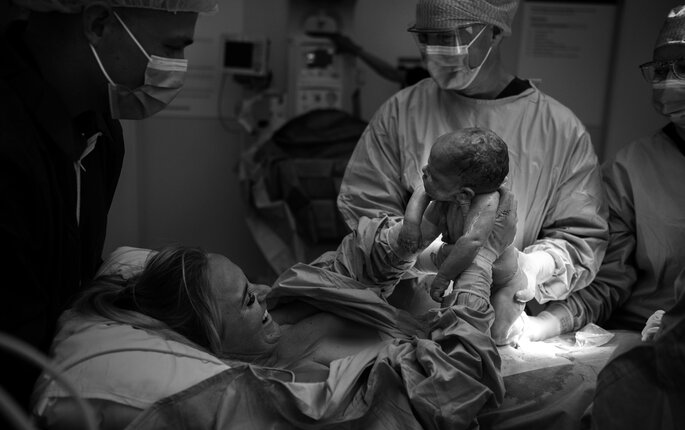 Bilde viser mor-asisterkeisersnitt