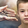 Bildet viser et par barnehender som holder noe jord og sand. Til høyre i bildet er ansiktet til en gutt som har meslinger