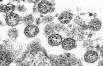 Bildet viser partikler fra koronavirus.
