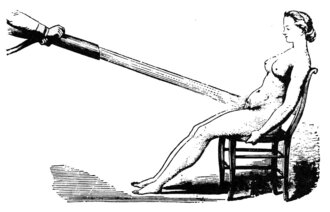 Illustrasjonen er en sort-hvitt tegning fra rundt 1860 av en kvinne som blir behandlet for hysteri med en kraftig vannstråle rettet mot underlivet
