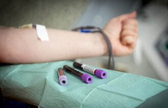 Bildet viser at det blir tatt blodprøver av et menneske. Ved siden av armen ligger tre prøveglass.