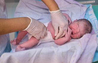 Bildet viser et nyfødt barn som får på seg en bleie
