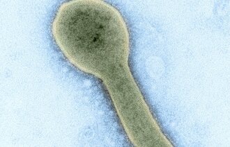 Bildet viser partikkel av marburgvirus.