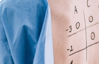 Bildet viser ryggen til en pasient påskrevet tall