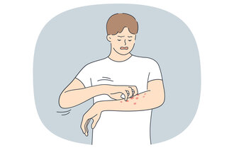 Illustrasjonen viser en mann som klør på et utslett på armen.