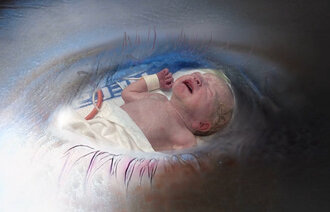 Fotomontasjen viser en baby tatt med keisersnitt, som skimtes gjennom et øye.