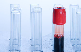 Bildet viser et blodprøveglass fylt med blod.