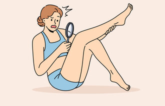 Illustrasjonen viser en kvinne som ser på benet sitt med forstørrelsesglass.