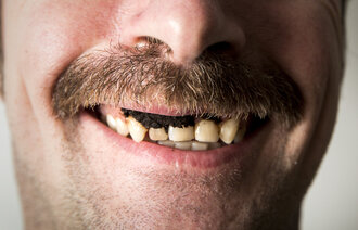 Bildet viser en mann som smiler med snus i leppa