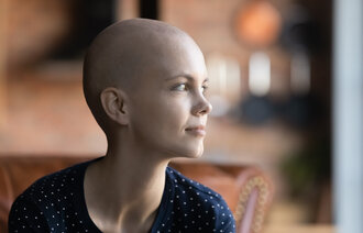 Bildet viser en ung kvinne uten hår, som antyder at hun får behandling for kreft