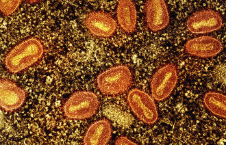 Bildet viser mpox-viruspartikler.