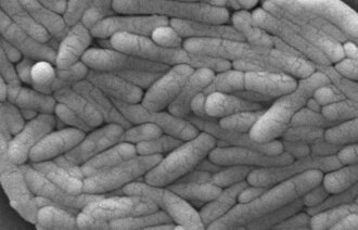 Bildet viser salmonellabakterier