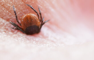 Bilde av flått som har satt seg fast på en hånd