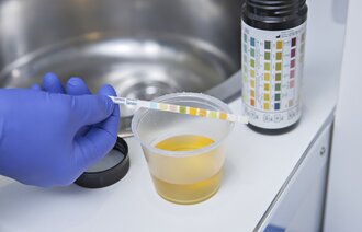 Bildet viser et prøveglass med urin og en strimmel med urinstix.