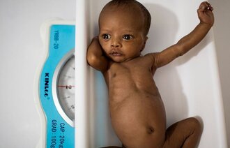Nyfødt prematur i Somalia på vekt 