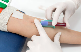 Bildet viser to  hender som tar blodprøve fra en arm.