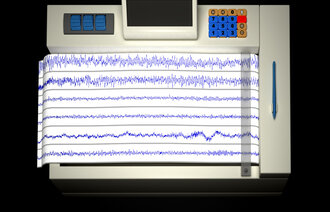 Illustrasjon av en EEG
