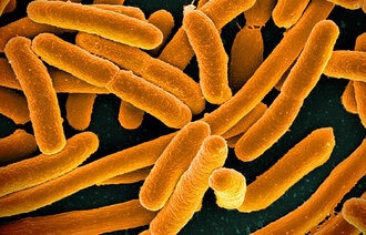 Bildet viser E. coli-bakterier