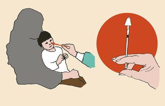 Illustrasjonen viser et barn som sederes med nesespray – intranasal deksmedetomidin – før anestesi. Til høyre ses sprøyten som brukes til administrering av medikamentet.