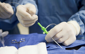 Bildet viser en kirurg som opererer