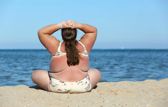 Bildet viser en overvektig kvinne bakfra, som sitter på stranden i bikini.