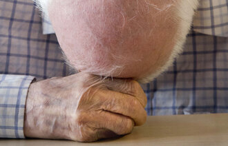 Bilde av mann som hviler hodet mot hendene