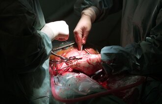 Nærbilde av helsepersonell som gjennomfører en operasjon