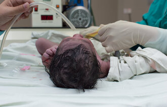 Bilde av en nyfødt prematur baby.