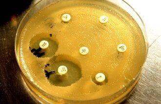 Bildet viser antibiotikaresistente bakterier i en petriskål