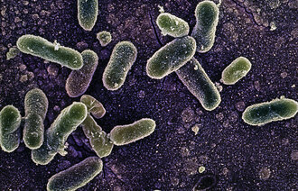 Bildet viser bakterier av typen salmonella enteritidis.