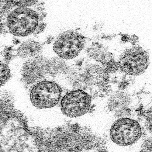Bildet viser partikler fra koronavirus.