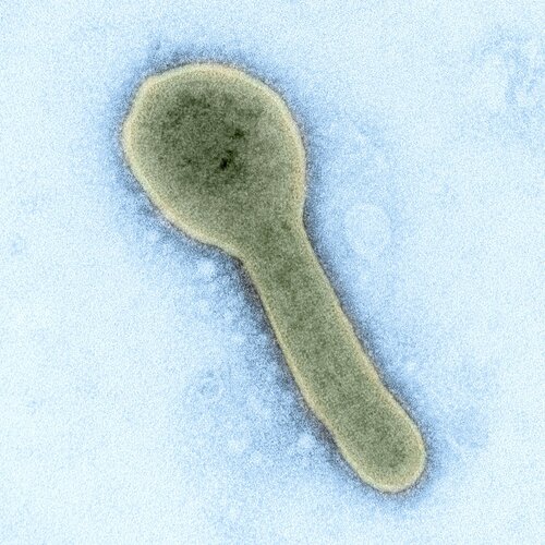 Bildet viser partikkel av marburgvirus.