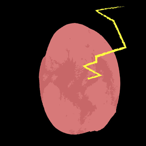 Hjerne Hjerne