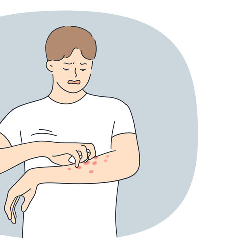 Illustrasjonen viser en mann som klør på et utslett på armen.