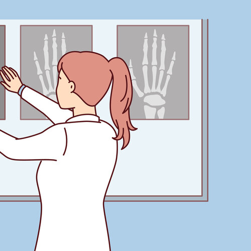 Illustrasjonen viser en helsearbeider som ser på røntgenbilder.